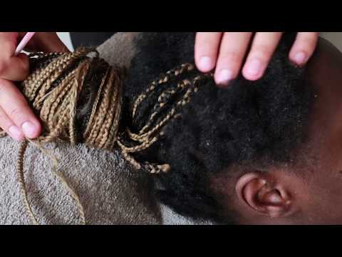 Crusty Dandruff Flakes Scratching From Braided 4C HAIR / Hair Play