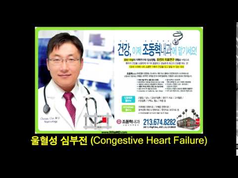 울혈성 심부전 - [조동혁 내과/신장내과] 100세 건강시대