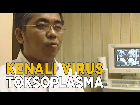 Toksoplasma virus ganas