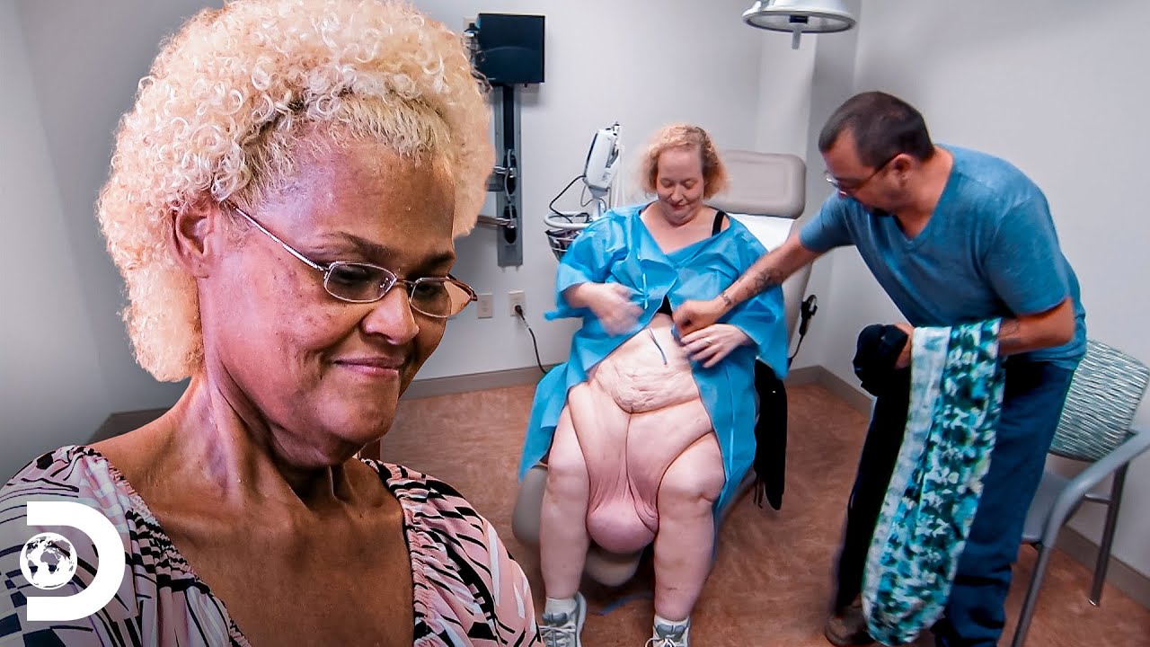 Mudanças incríveis após remoção de pele | Quilos mortais: Como eles estão agora? | Discovery Brasil