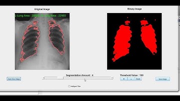 Lung Segmentation Glimpse a MATLAB GUI