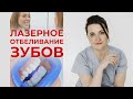 Отбеливание зубов #2 / Как отбеливают зубы? Процесс лазерного отбеливания зубов