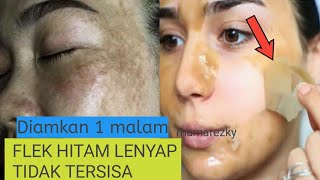GOSOK SAYUR PARE FLEK HITAM LENYAP TIDAK TERSISAH WAJAH MULUS