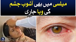 Conjunctivitis cases also continues in Melsi - Aaj News