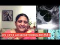 Follicular Monitoring- DR PRERNA GUPTA