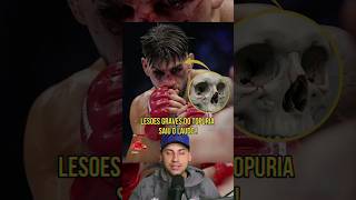 O NEGOCIO FEIO PRA O TOPURIA !? #ufc #topuria #mma #iliatopuria