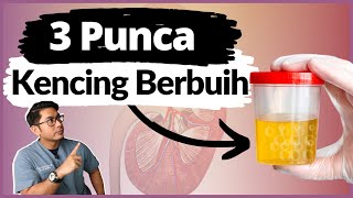 Buah Pinggang Rosak & Kencing Berbuih | Doctor Sani |