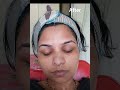 my work bleach facial before and after results #beauty skincare #youtube