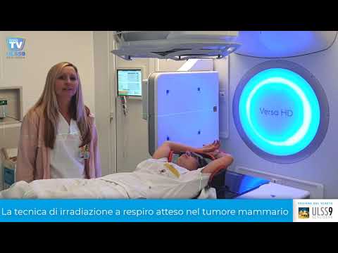 Video: Valutazione Della Radioterapia Con Particelle Per La Ri-irradiazione Del Meningioma Intracranico Ricorrente