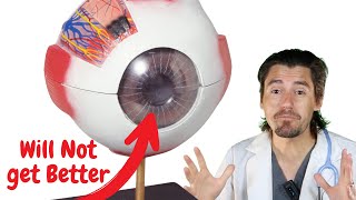 How a Vet will fix an Eye Ulcer that WILL NOT heal in dogs. Dog Corneal Ulcer Not Healing Dr Dan Explains Why And How To Fix