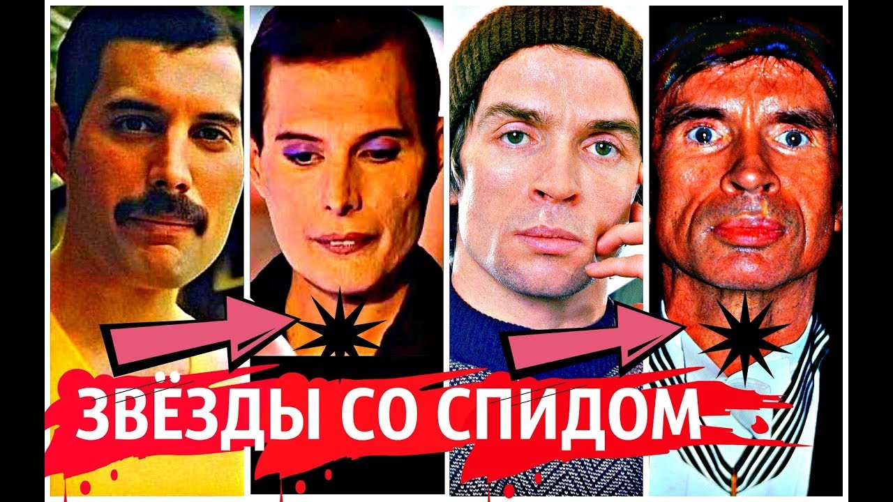 Звёзды которых ЗАБРАЛ СПИД