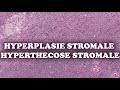 Lhyperplasie stromale  lhyperthecose stromale  pathologie