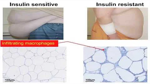 IL6 in Health and Disease