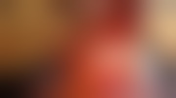 Mitral Annular Calcification,  Mitral Valve Replacement, new technique