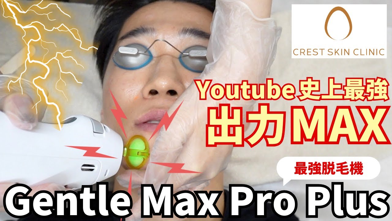 【最強パワー】最新のGentle Max Pro Plusを使って高出力で髭脱毛をしてみた結果、、、【クレストスキンクリニック】
