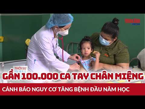 Nearly 100,000 Hand, Foot, and Mouth Disease Cases, Warning of Rising Risks at the Start of the S...