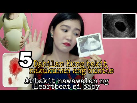 Video: Paano Mag-recover mula sa isang Pagkalaglag: 12 Hakbang (na may Mga Larawan)