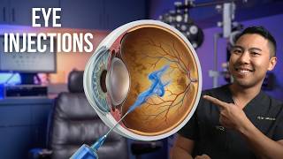 Eye Injections: Everything You Need to Know