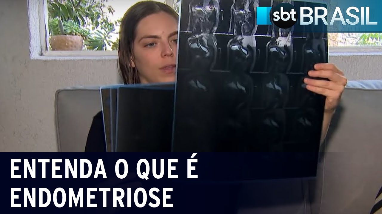 Entenda o que é endometriose, doença que atinge 7 milhões de brasileiras | SBT Brasil (20/07/22)