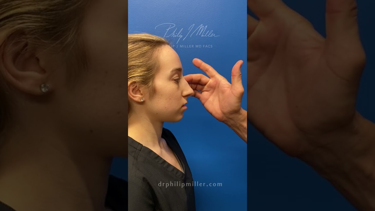 What Are the Differences Between Surgical Rhinoplasty vs Liquid Rhinoplasty!
