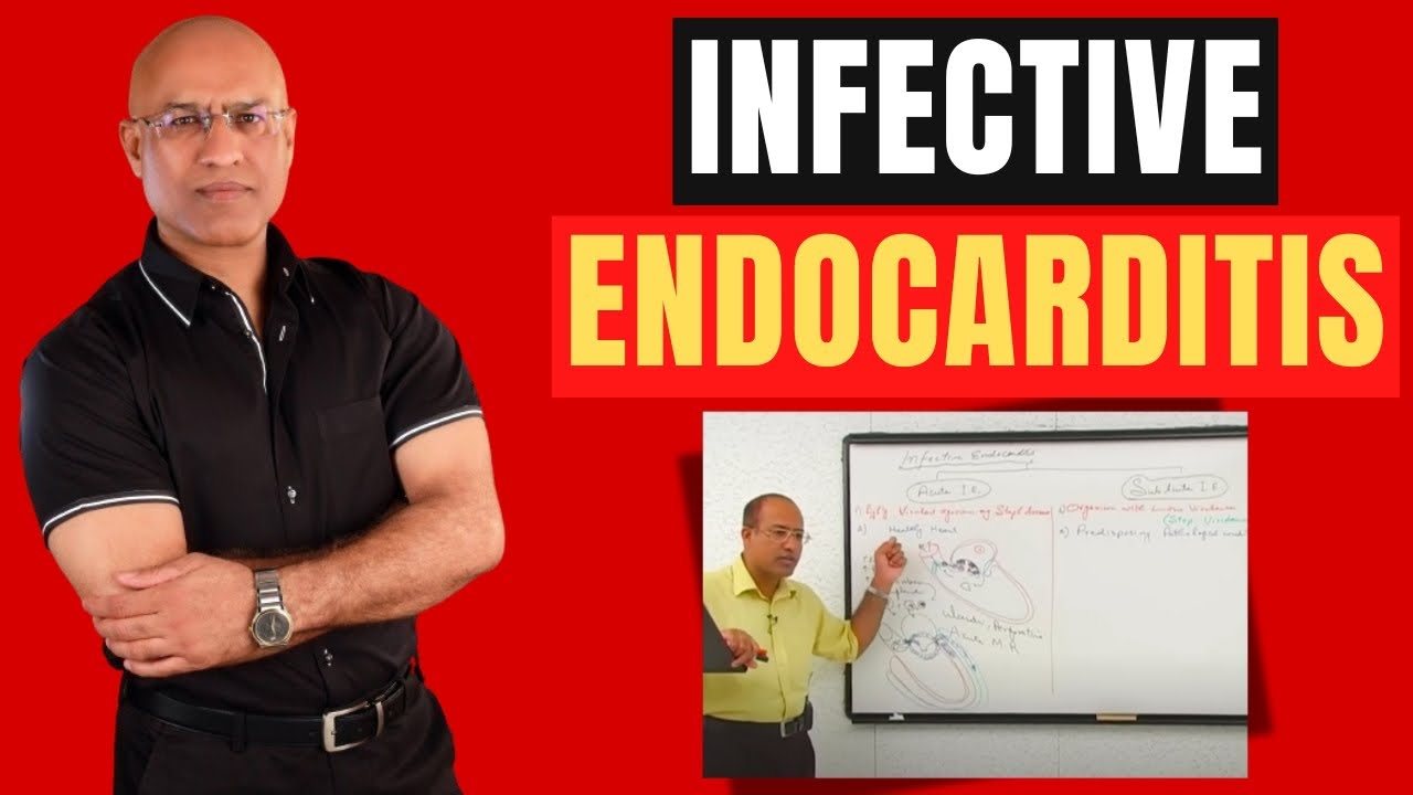 Infective Endocarditis | Cardiac Pathology | Cardiology🫀