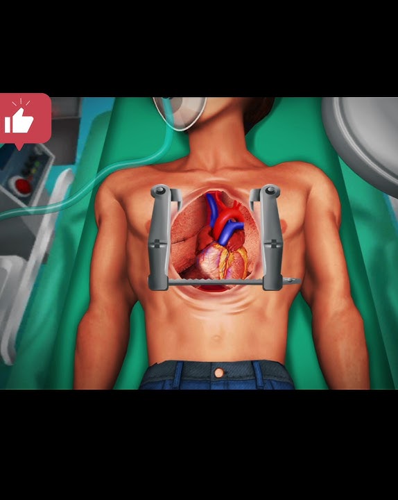 #3d #open #heart surgery in #best #animation video