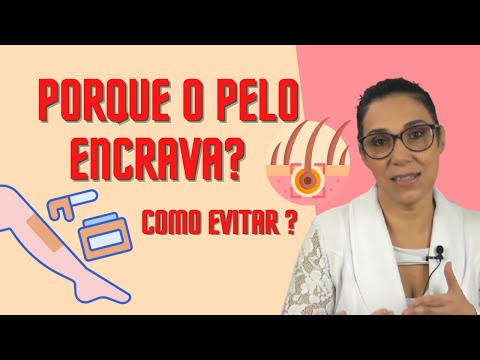 Vídeo: Como prevenir os cabelos encravados após a depilação: 11 etapas