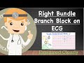 Right Bundle Branch Block on 12 Lead ECG - Identification and Diagnostic Criteria [Actual ECGs!]