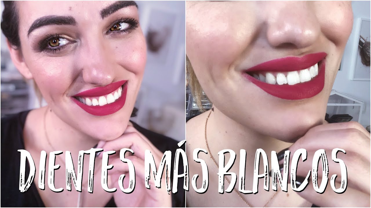 Como tener los dientes blancos en casa