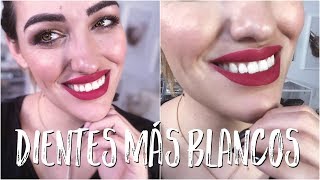 DIENTES BLANCOS EN CASA - Tiras blanqueadoras, rutina higiene y consejos screenshot 1