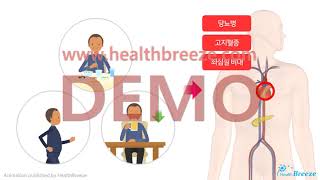 [Demo] A Guide to Lifestyle Management for Hypertension Patients