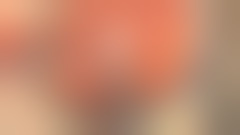 Acrylic IOL Cutting with the Packer/Chang IOL Cutters