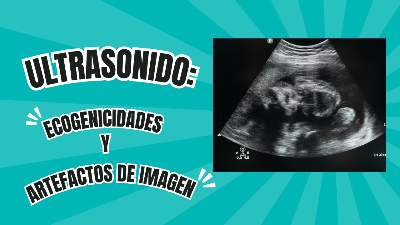 Ecogenicidades y Artefactos de la Imagen de USG
