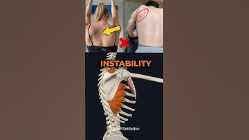 Shoulder Blade Unstable + Out of Sync?