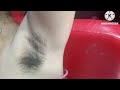 underarms waxing/waxing armpits/waxing underarms @pummybeautyworld @sonimakeover