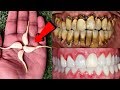 सिर्फ 2 मिनटों में पीले गंदे दांतों को मोती की तरह चमका देगा ये नुस्खा | White Teeth home remedy