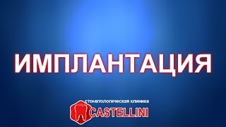 Операция имплантация, позиции 14, 24, 25 зубов(Операция имплантация, позиции 14, 24, 25 зубов в клинике Кастеллини. Хирург-имплантолог Абдулжалилов Магомед..., 2016-04-29T14:34:05.000Z)