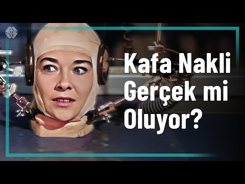 Kafa Nakli İle İlgili Tüm Gerçekler