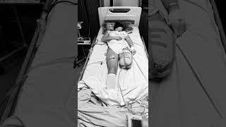 Tell a friend. I’m back. #ShesBack #YearOff #Survivor #Trauma #AmputeeGirl