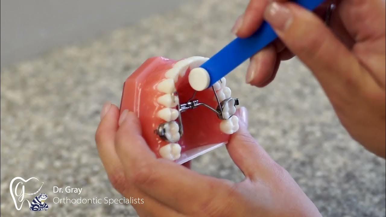 How to Turn Expander YouTube