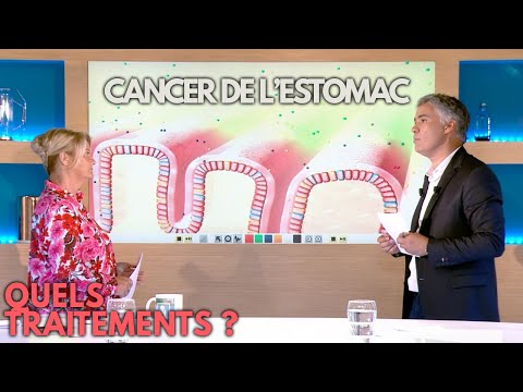 Vidéo: Cancer De L'estomac - Symptômes, Traitement, Pronostic