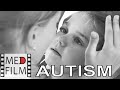 Аутичные дети. Лечение аутизма © Autistic children, autism treatment