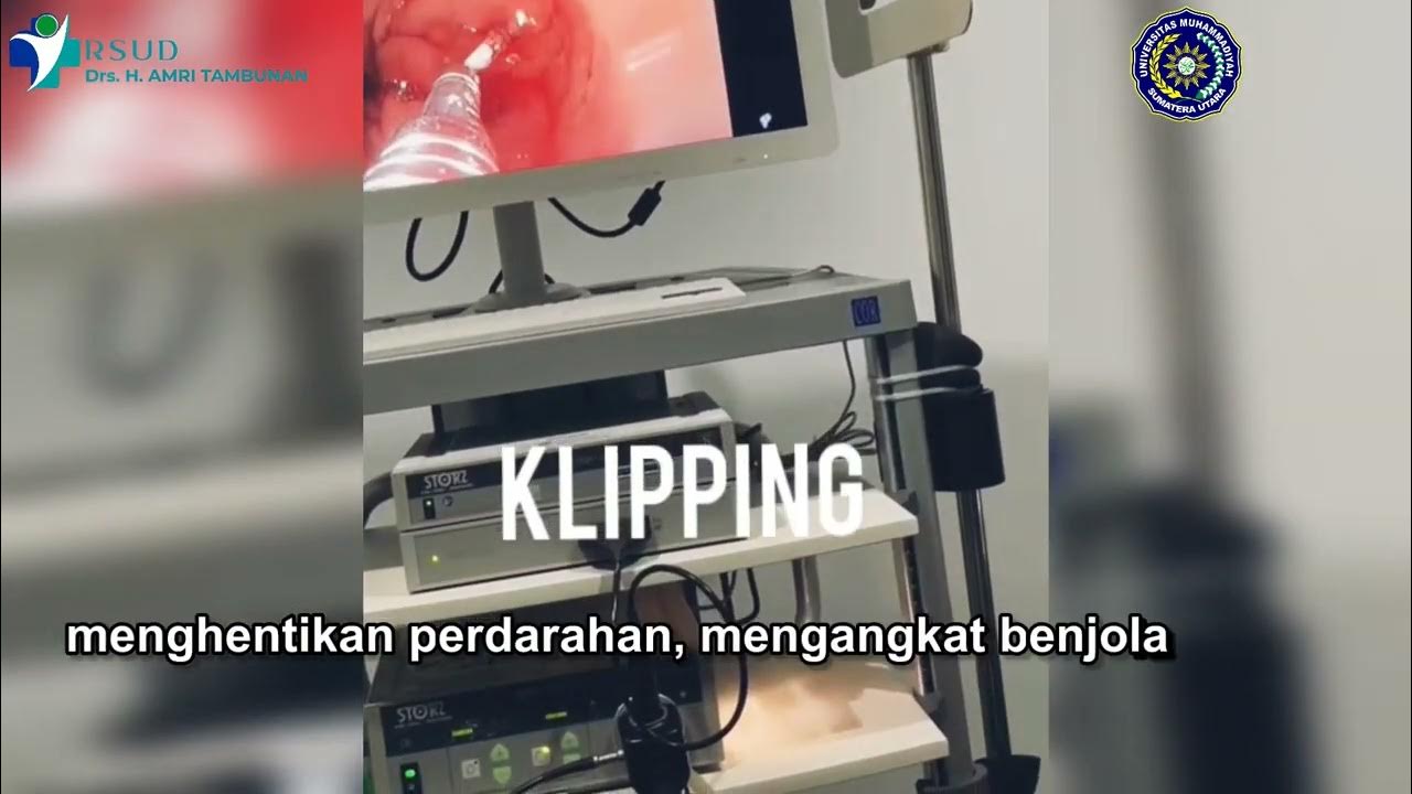 Pembelajaran ENDOSKOPI di RSUD Drs. H Amri Tambunan / FK UMSU YouTube