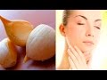 Propiedades del ajo para la piel   beneficios del ajo en la piel