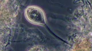 Vorticella aquadulcis-complex (stress) in activated sludge