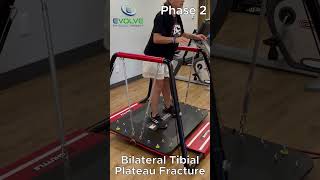 Bilateral Tibial Plateau Fractures: Improving Dynamic Knee Stability on an Unstable Surface