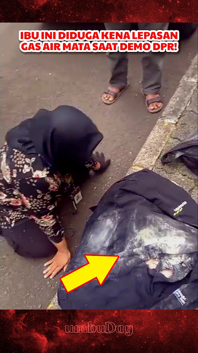 Hit by TEAR GAS! This woman's wedge was pierced on her way home from work #demo #dpr #police #dpr...