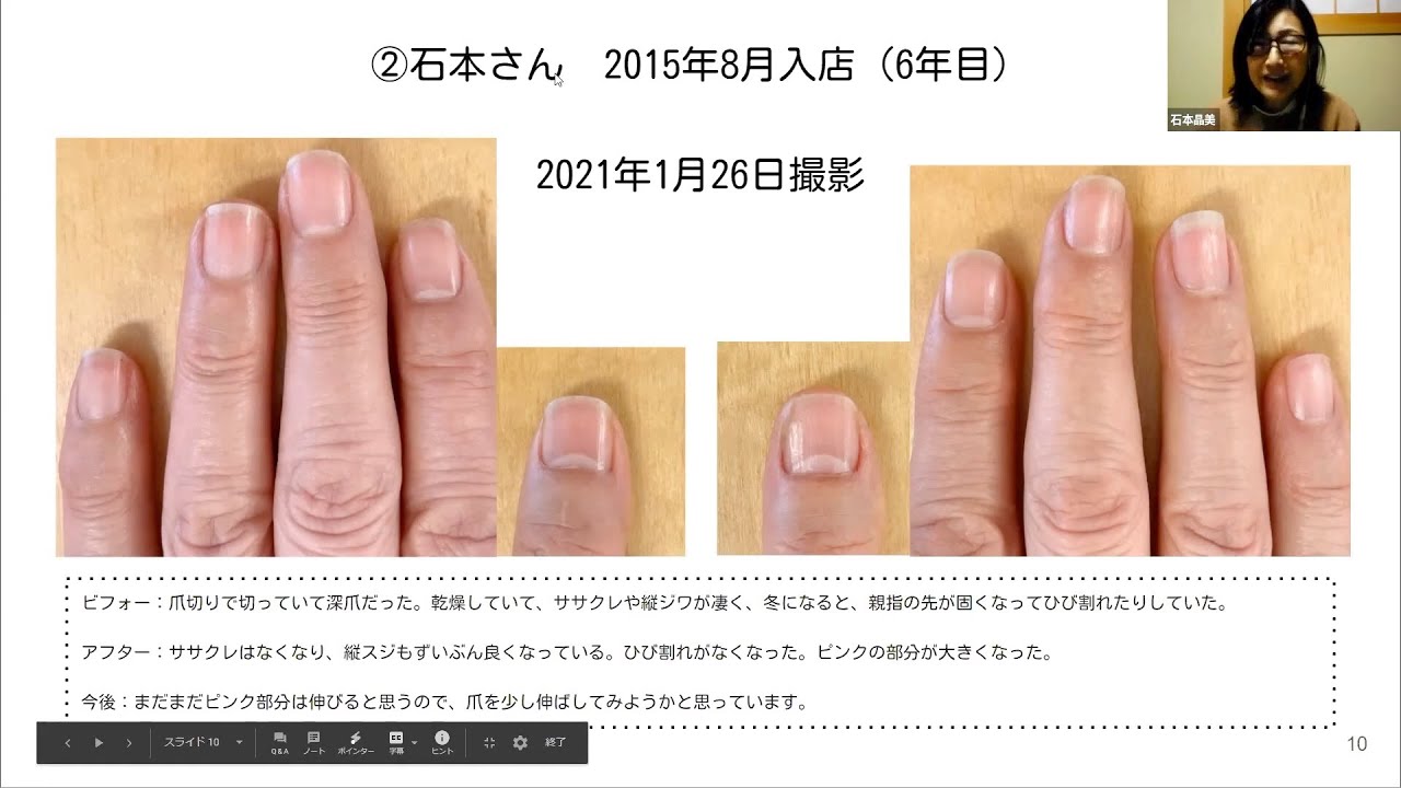 育爪をはじめてからも オイルをまめに塗れない 雑に手を使ってしまう わたしの爪をキレイにするのは無理かもと思っていました Youtube