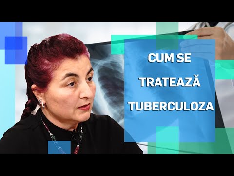 Cum se tratează tuberculoza