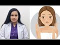 Doctor ki Advice follow karey or paaye ek glowing skin ✨️ 😍